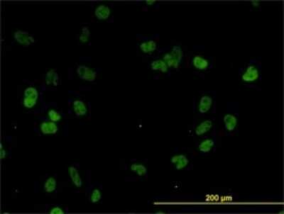 Immunocytochemistry/ Immunofluorescence: CSTF3 Antibody (1D4) [H00001479-M01]