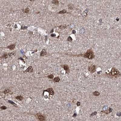 Immunohistochemistry-Paraffin: CSTF3 Antibody [NBP1-85427]