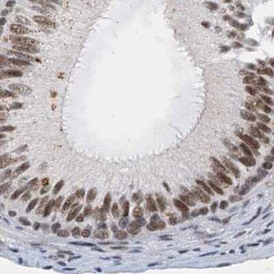 Immunohistochemistry-Paraffin: CSTF3 Antibody [NBP1-85428]