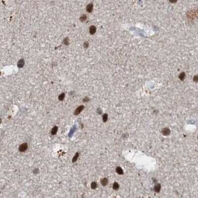 Immunohistochemistry-Paraffin: CSTF3 Antibody [NBP1-85428]