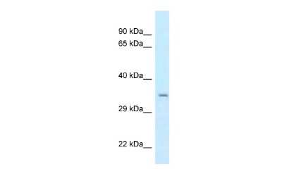 Western Blot: CSTP1 Antibody [NBP2-87223]