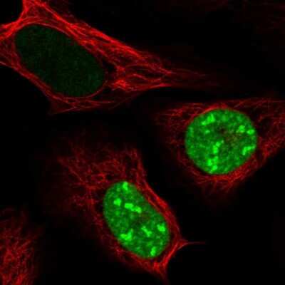 Immunocytochemistry/ Immunofluorescence: CT45A1 Antibody [NBP2-46702]