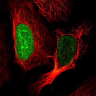 Immunocytochemistry/ Immunofluorescence: CT45A1 Antibody [NBP2-46729]