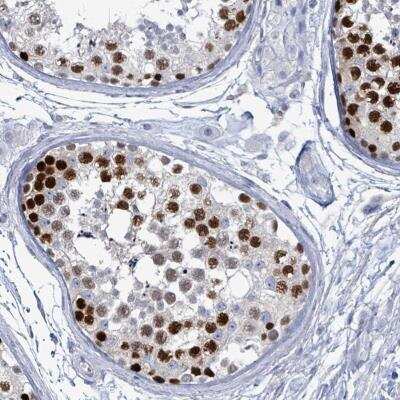 Immunohistochemistry: CT45A1 Antibody [NBP2-46729]