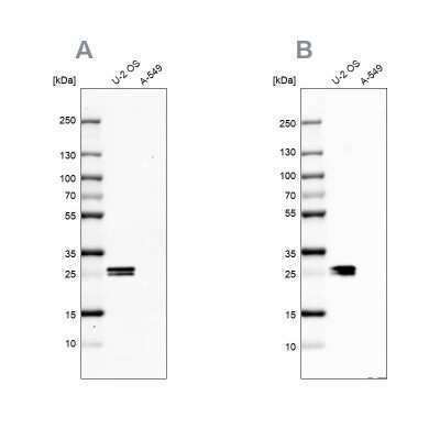 Western Blot: CT45A1 Antibody [NBP2-46729]