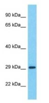 Western Blot: CT47A12 Antibody [NBP3-09916]