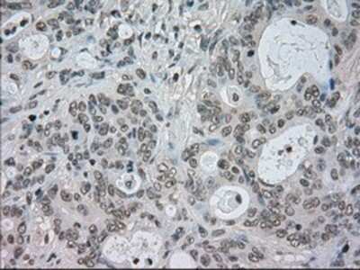 Immunohistochemistry-Paraffin: CTAG1B Antibody (OTI2B6) [NBP1-47714]