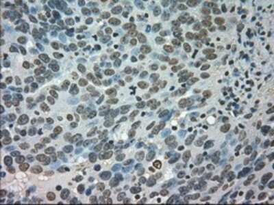Immunohistochemistry-Paraffin: CTAG1B Antibody (OTI2B6) [NBP1-47714]