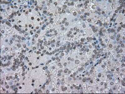 Immunohistochemistry-Paraffin: CTAG1B Antibody (OTI2B6) [NBP1-47714]