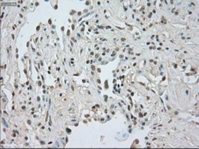 Immunohistochemistry-Paraffin: CTAG1B Antibody (OTI2B6) [NBP1-47714]
