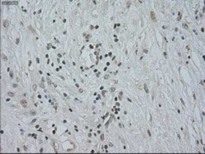 Immunohistochemistry-Paraffin: CTAG1B Antibody (OTI2B6) [NBP1-47714]