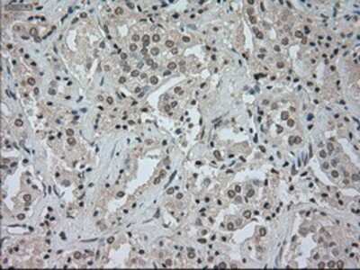 Immunohistochemistry-Paraffin: CTAG1B Antibody (OTI2B6) [NBP1-47714]
