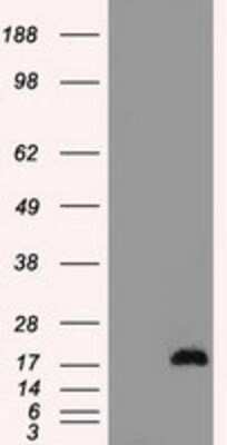 Western Blot: CTAG1B Antibody (OTI2B6) [NBP1-47714]