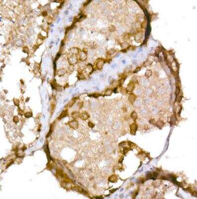 Immunohistochemistry-Paraffin: CTAG1B Antibody - Azide and BSA Free [NBP2-92840]