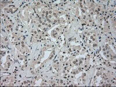 Flow Cytometry: CTAG1B Antibody (OTI2B6) - Azide and BSA Free [NBP2-70485]