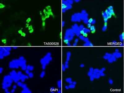 Immunocytochemistry/ Immunofluorescence: CTAG1B Antibody (OTI2B6) - Azide and BSA Free [NBP2-70485]