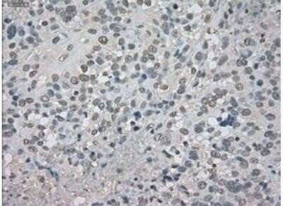 Immunohistochemistry: CTAG1B Antibody (OTI2B6) - Azide and BSA Free [NBP2-70485]