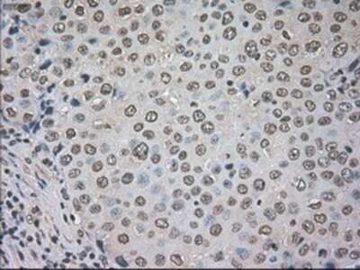 Immunohistochemistry: CTAG1B Antibody (OTI2B6) - Azide and BSA Free [NBP2-70485]