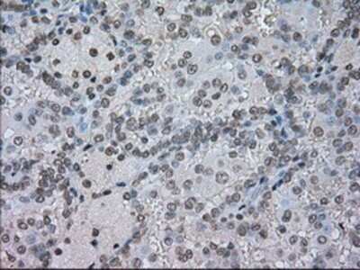 Immunohistochemistry: CTAG1B Antibody (OTI2B6) - Azide and BSA Free [NBP2-70485]