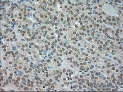 Immunohistochemistry: CTAG1B Antibody (OTI2B6) - Azide and BSA Free [NBP2-70485]