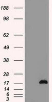 Western Blot: CTAG1B Antibody (OTI2B6)Azide and BSA Free [NBP2-70485]