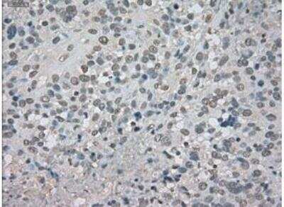 Immunohistochemistry-Paraffin: CTAG1B Antibody (OTI2B6) [NBP1-47714]