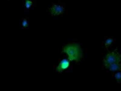 Immunocytochemistry/ Immunofluorescence: CTAG1B Antibody (OTI5H4) - Azide and BSA Free [NBP2-70486]