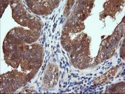 Immunohistochemistry: CTAG1B Antibody (OTI5H4) - Azide and BSA Free [NBP2-70486]