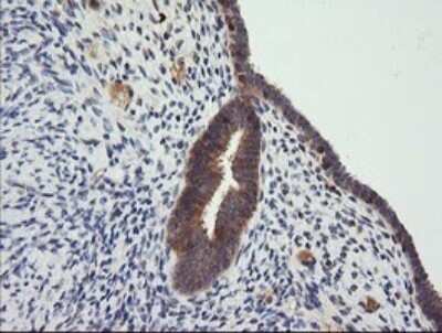 Immunohistochemistry: CTAG1B Antibody (OTI5H4) - Azide and BSA Free [NBP2-70486]