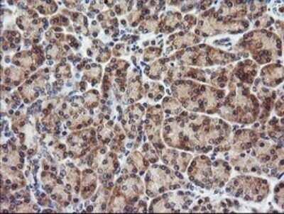 Immunohistochemistry: CTAG1B Antibody (OTI5H4) - Azide and BSA Free [NBP2-70486]