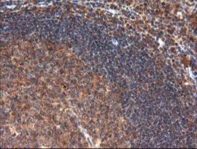 Immunohistochemistry: CTAG1B Antibody (OTI5H4) - Azide and BSA Free [NBP2-70486]