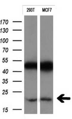 Western Blot: CTAG1B Antibody (OTI5H4)Azide and BSA Free [NBP2-70486]