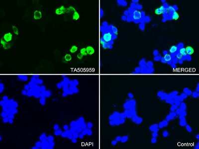 Immunocytochemistry/ Immunofluorescence: CTAG1B Antibody (OTI5H4) [NBP2-46386]
