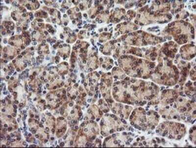 Immunohistochemistry: CTAG1B Antibody (OTI5H4) [NBP2-46386]