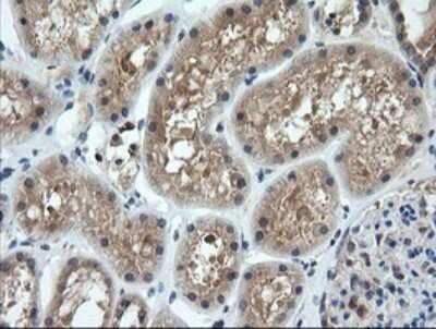 Immunohistochemistry: CTAG1B Antibody (OTI5H4) [NBP2-46386]
