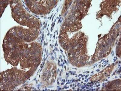 Immunohistochemistry: CTAG1B Antibody (OTI5H4) [NBP2-46386]