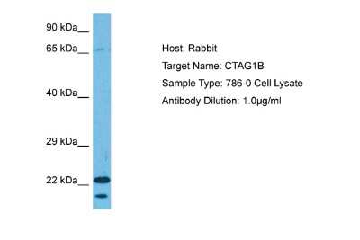 Western Blot: CTAG1B Antibody [NBP2-88796]