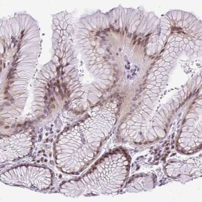 Immunohistochemistry: CTB-133G6.1 Antibody [NBP2-48929]