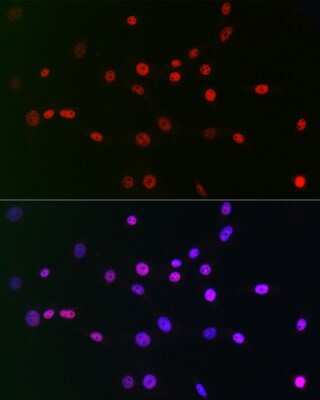 Immunocytochemistry/ Immunofluorescence: CTBP2 Antibody (1R1U6) [NBP3-15268]