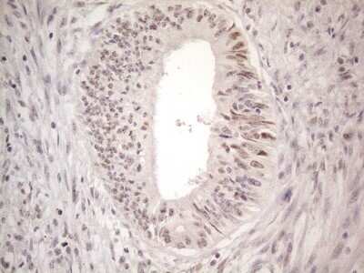Immunohistochemistry: CTBP2 Antibody (OTI4D4) [NBP2-46390]