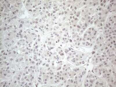 Immunohistochemistry: CTBP2 Antibody (OTI4D4) [NBP2-46390]