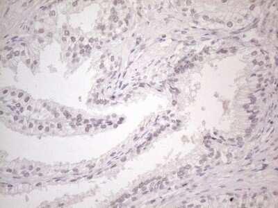 Immunohistochemistry: CTBP2 Antibody (OTI4D4) [NBP2-46390]