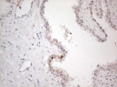 Immunohistochemistry: CTBP2 Antibody (OTI4D4) [NBP2-46390]