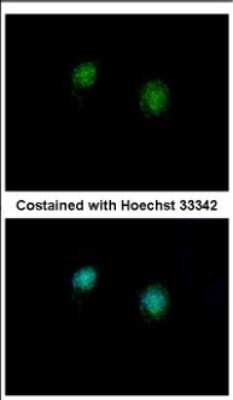 Immunocytochemistry/ Immunofluorescence: CTBP2 Antibody [NBP2-16024]