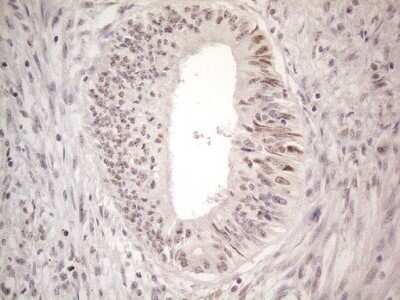 Immunohistochemistry: CTBP2 Antibody (OTI4D4) - Azide and BSA Free [NBP2-70487]