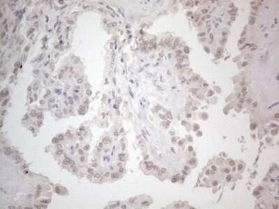 Immunohistochemistry: CTBP2 Antibody (OTI4D4) - Azide and BSA Free [NBP2-70487]