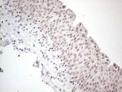 Immunohistochemistry: CTBP2 Antibody (OTI4D4) - Azide and BSA Free [NBP2-70487]