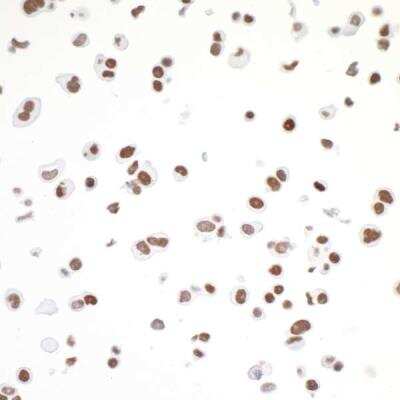 Immunocytochemistry: CTCF Antibody (BLR041F) [NBP2-76420]