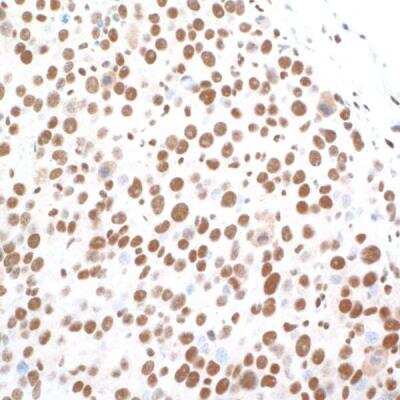 Immunohistochemistry: CTCF Antibody (BLR041F) [NBP2-76420]