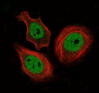 Immunocytochemistry/ Immunofluorescence: CTCF Antibody (CL0304) [NBP2-52909]